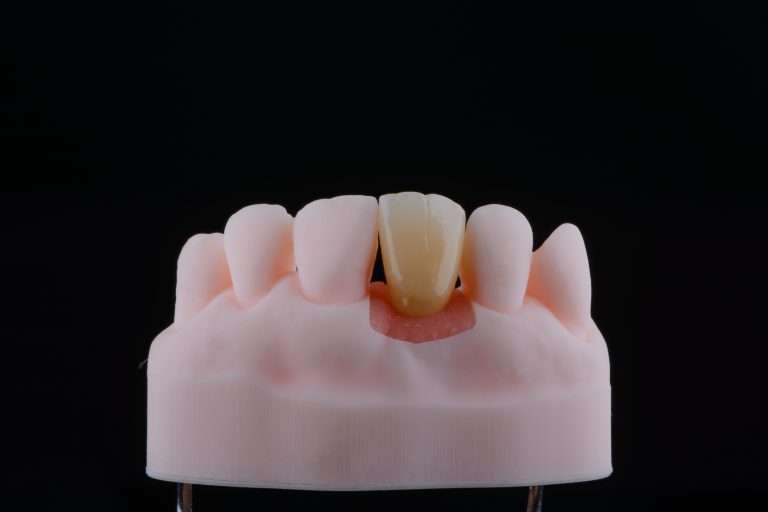 zirconia crown