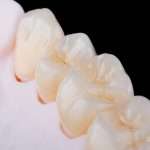 highquality-naturally-dental-single-crowns-made-zirconium-fixation-teeth-upper-jaw