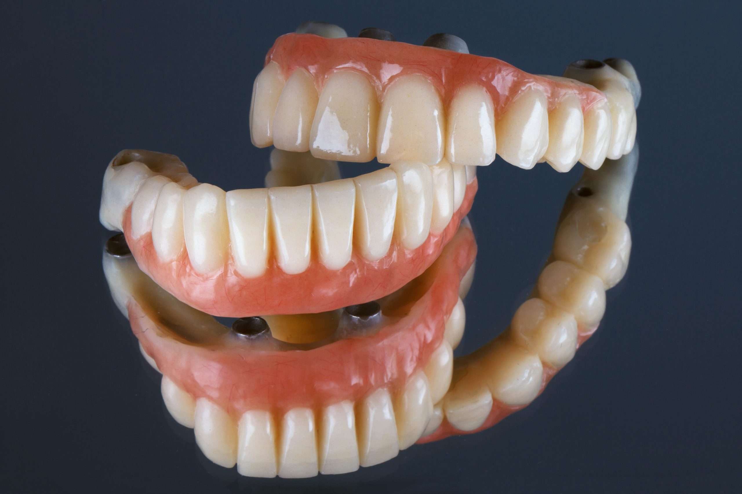 cassa in zirconia