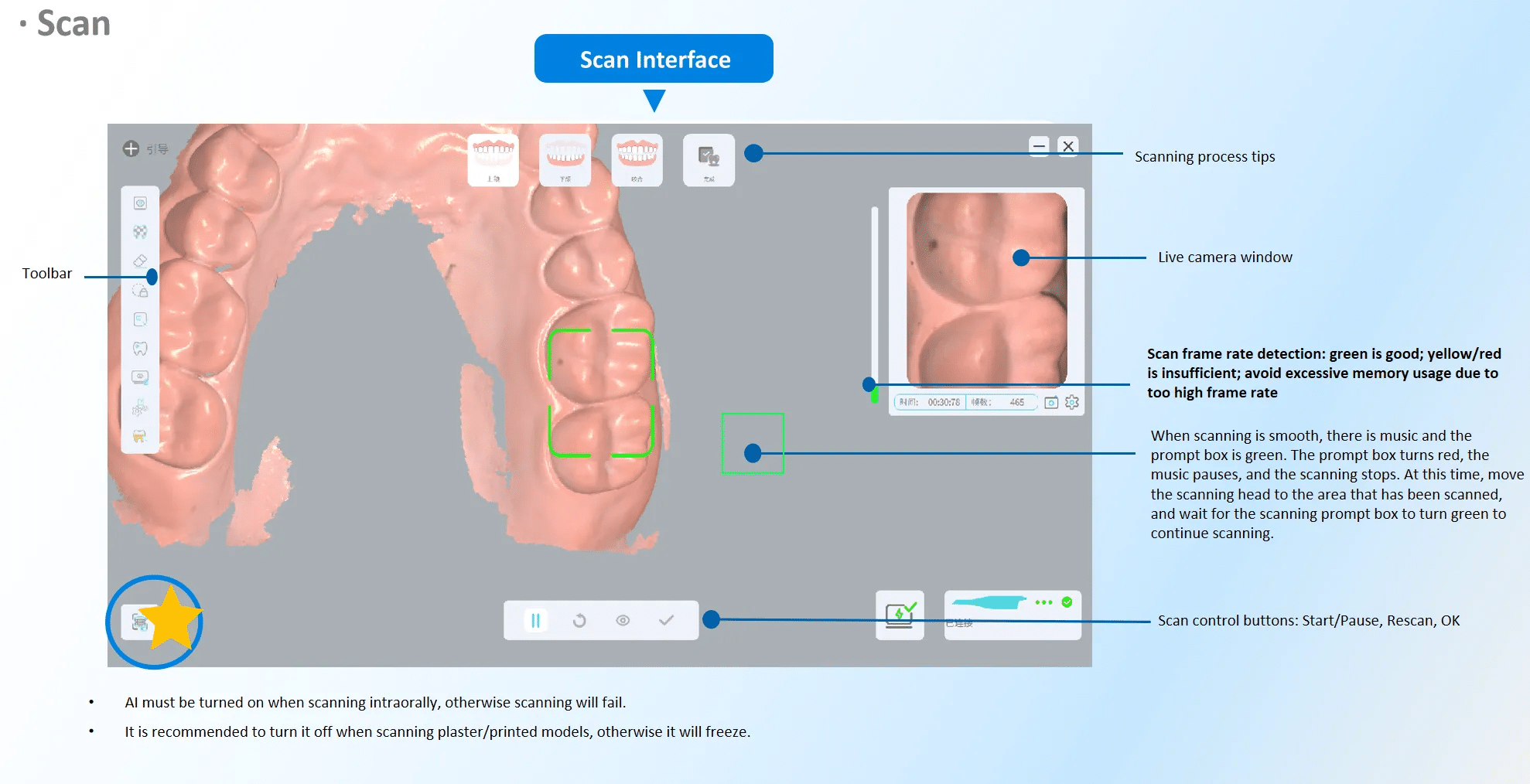 Dental 3D Intraoral Scanner