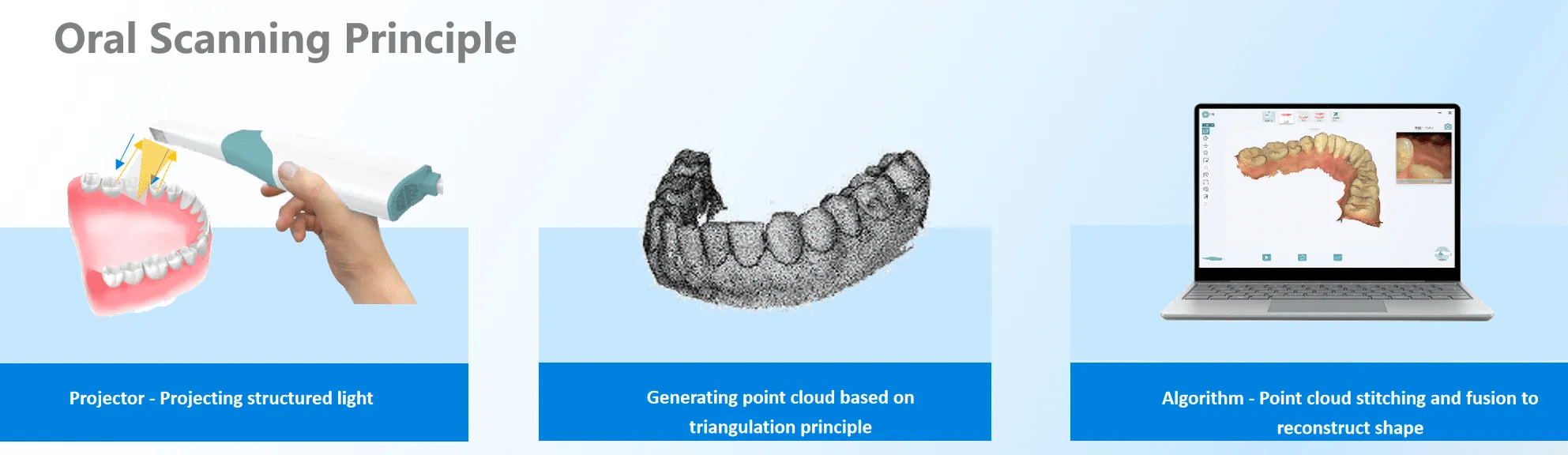 Dental 3D Intraoral Scanner