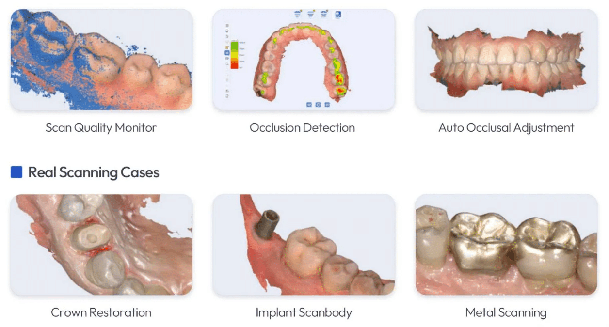 Dental 3D Intraoral Scanner