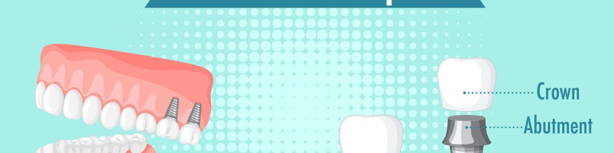 implante dental