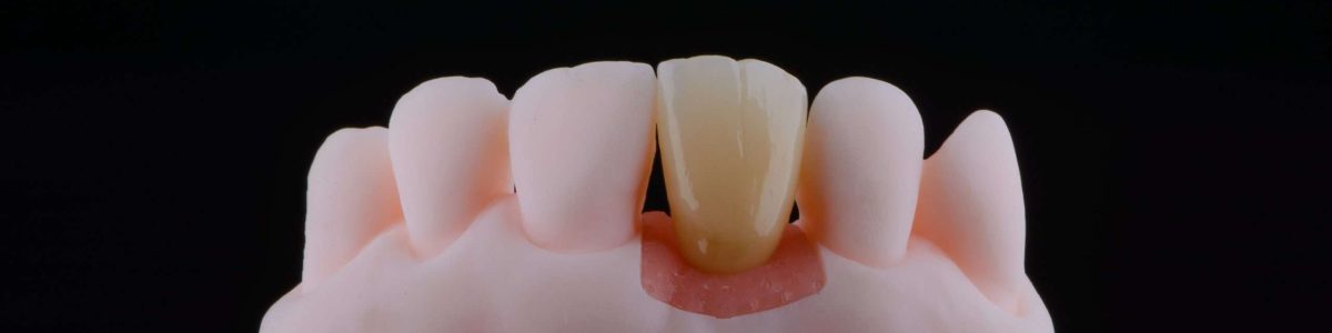 zirconia crown